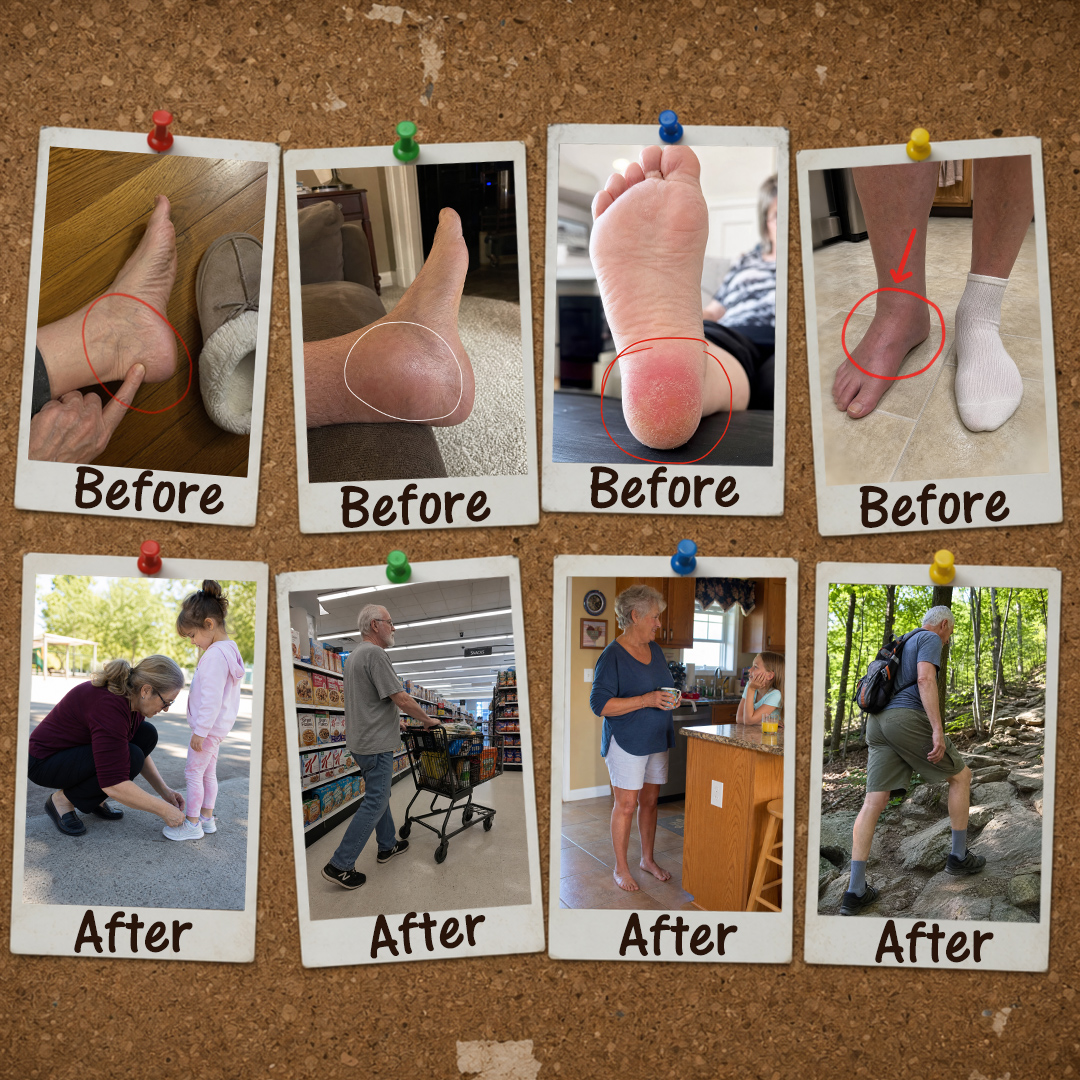 Before and after photos of a woman struggling with morning foot pain and then walking pain-free outside